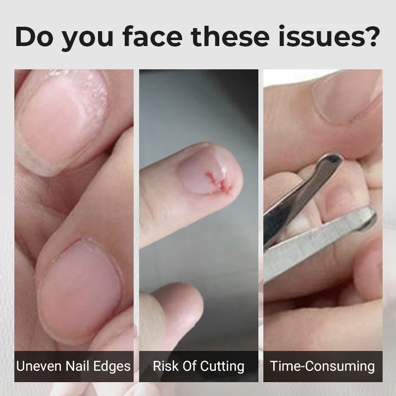 🎁 Hot Sale 49%OFF🔥3 in 1 Automatic Electric Nail Clipper with Polishing【Safe and convenient】 - Image 2