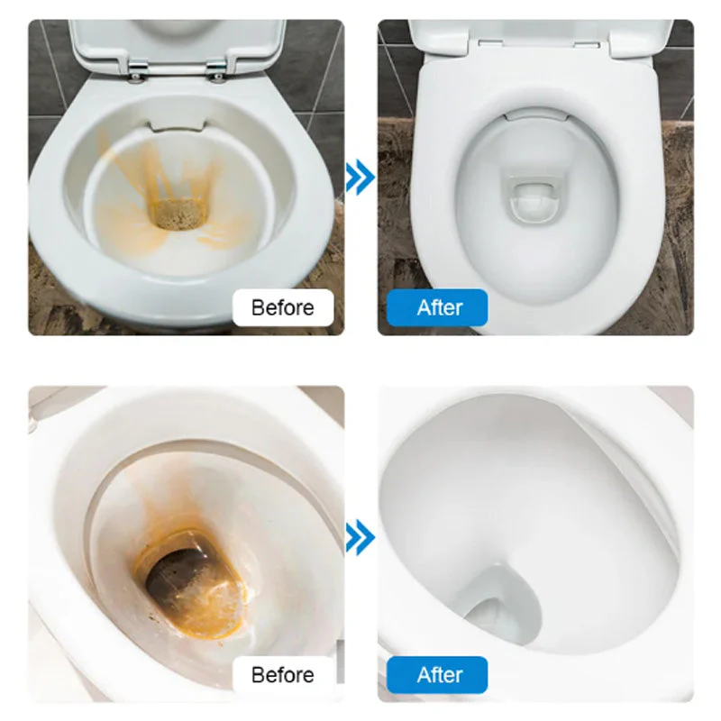 👉Powerful Toilet Bowl Cleaner Tablets💥Get 50% to 70% off for a limited time! - Image 3